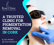 Rose Clinic – A trusted clinic for pigmentation removal in Cork!