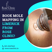 Book mole mapping in Limerick from Rose Clinic!