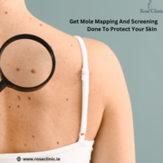 Get Mole Mapping And Screening Done To Protect Your Skin