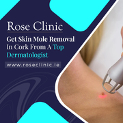 Rose Clinic: Expert Mole Check and Screening in Cork