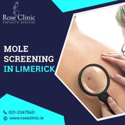 Best medical team for mole mapping in Limerick | Rose Clinic